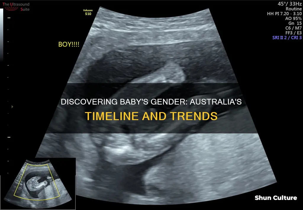 when do you find out baby gender australia