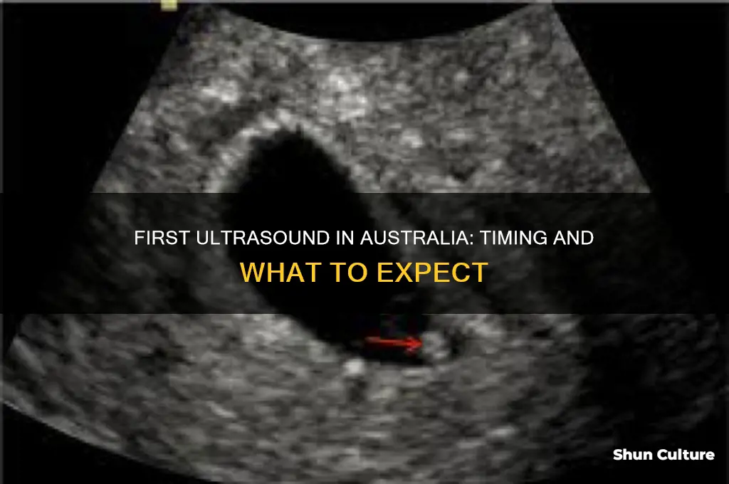 when do you have first ultrasound australia