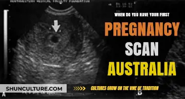 First Pregnancy Scan in Australia: Timing and What to Expect