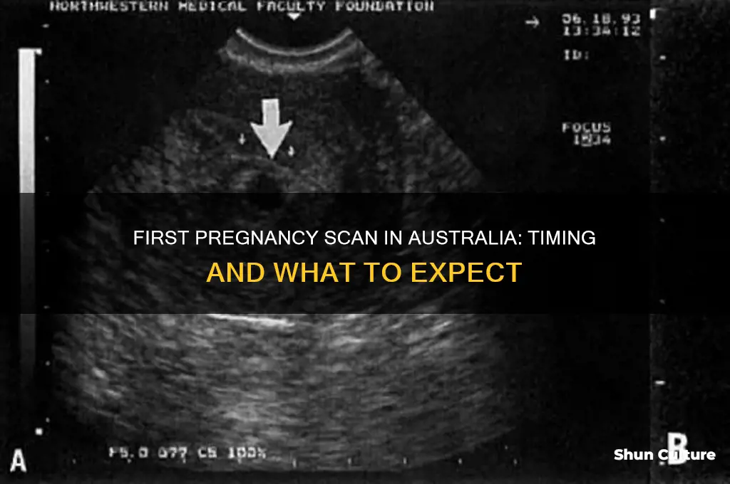 when do you have your first pregnancy scan australia