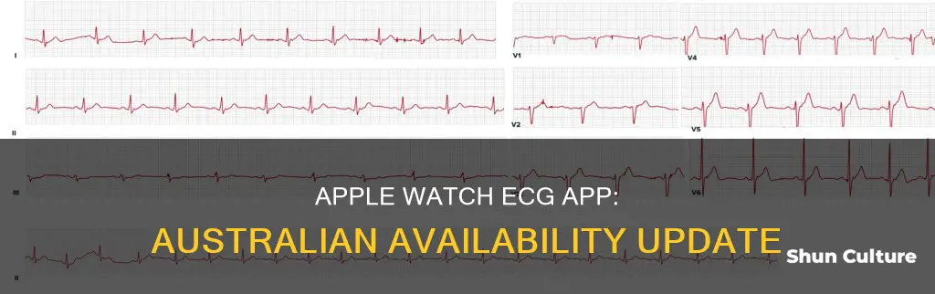 when is ecg app coming to australia