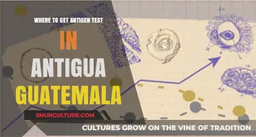 Antigua Guatemala Antigen Test Locations: Quick & Convenient Testing Spots