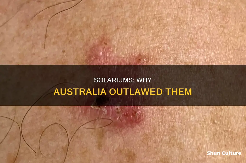 why are solariums illegal in australia