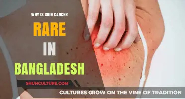 Unveiling Bangladesh's Skin Cancer Rarity: Cultural, Climatic, and Genetic Factors