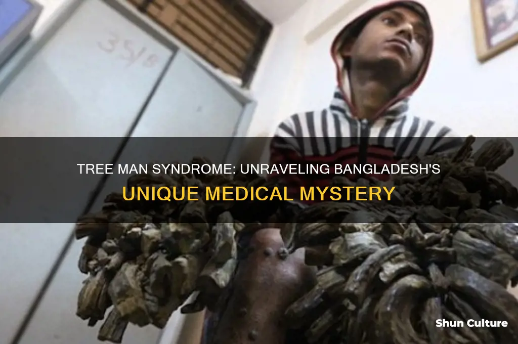 why tree man syndrome is only in bangladesh